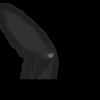 SPORK, NICO - 22.03.1976 - 02.08.2022 - CT obere Extremität - 18:01:46